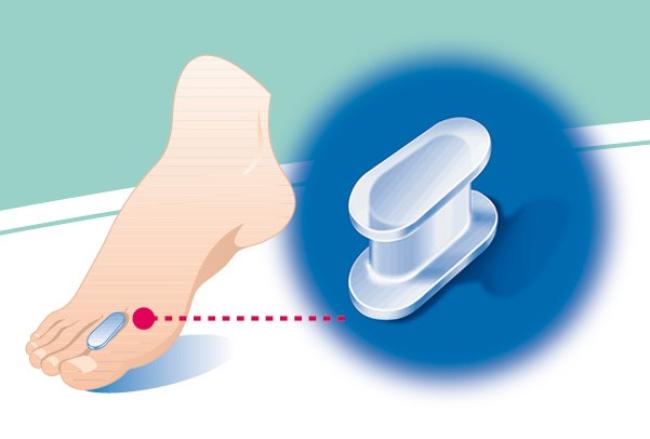 Podogel Hallux Valgus Corrector Small 33/36 (412)