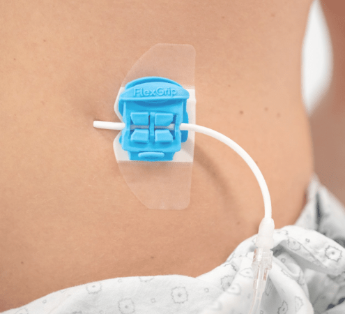 FlexGRIP Universal Katheterfixatie - CH5 tem 11 - per stuk