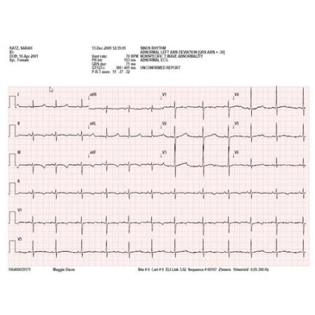 ECG-papier zigzag 108 x 140mm (voor o.a. Mortara ELI150) (200 pag.) - per stuk